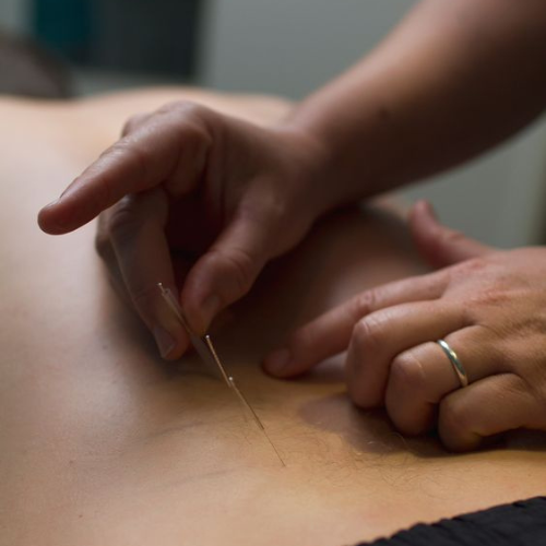 Acupunctures Healing Touch